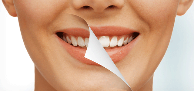 How to Stop Receding Gums: Protecting Your Dental Health