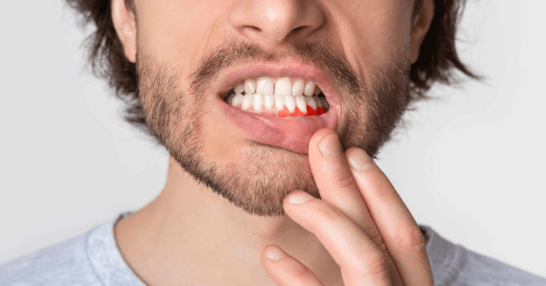 A Threat: The Bottom Teeth Receding Gums